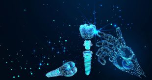 ایمپلنت دیجیتال چقدر زمان می برد ؟